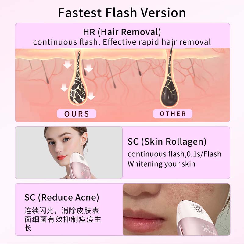Alat Penghilang Bulu Portabel  - Epilator Wireless ulasan dan harga